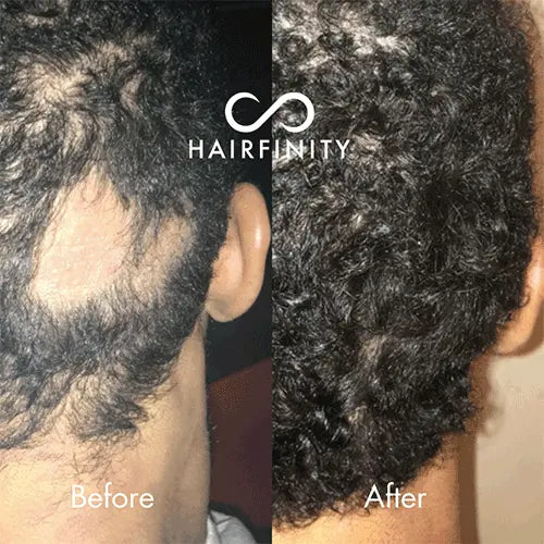 Hair Infinity Infinite Edges sérum cheveux 15 ml tempes
