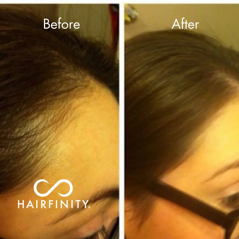 Hair Infinity Growth Boosters kit edges huile et sérum