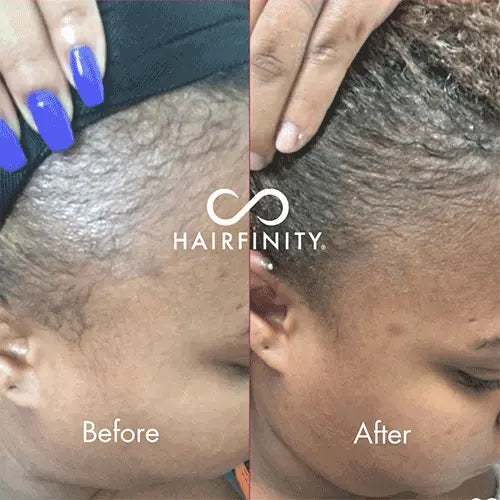 Hair Infinity Infinite Edges sérum cheveux 15 ml tempes